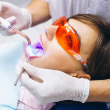 The Long-Term Benefits of Laser Frenectomy: Lifelong Oral Health