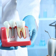 Are Dental Implants the Answer to Your Missing Tooth Woes?