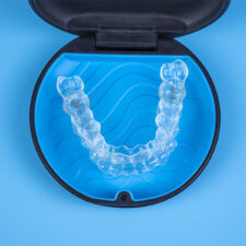 Invisalign in Citrus Heights: What You Need to Know Before You Start